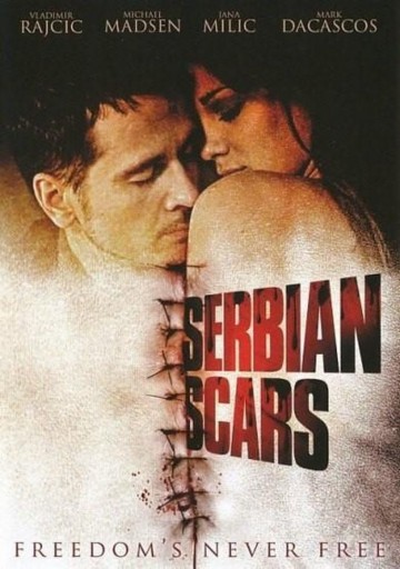 Serbian Scars