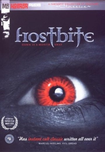 Frostbite